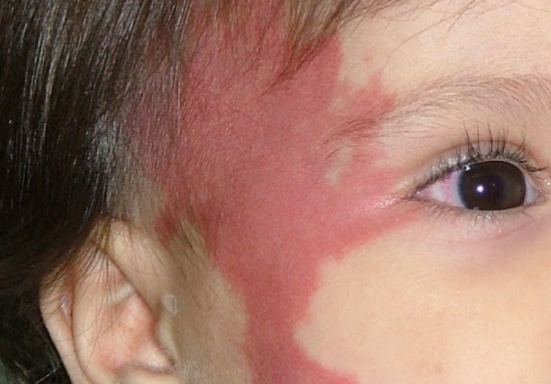 Odoo - Ejemplo 1 para tres columnas