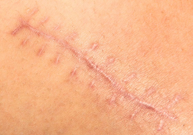 Odoo - Ejemplo 1 para tres columnas