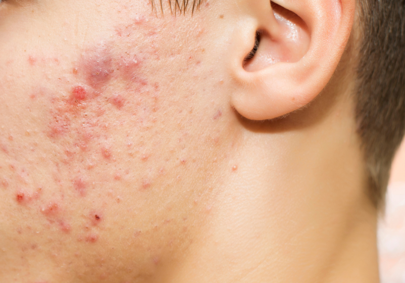 Odoo - Ejemplo 1 para tres columnas