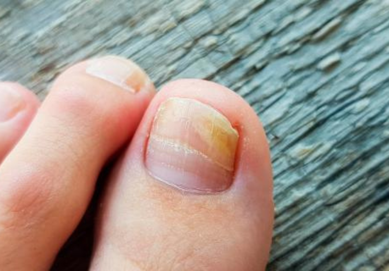 Odoo - Ejemplo 1 para tres columnas