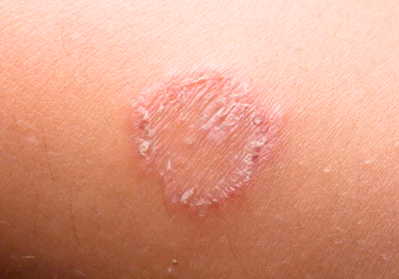 Odoo - Ejemplo 1 para tres columnas