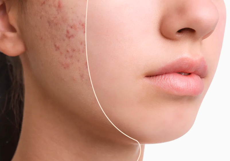 Odoo - Ejemplo 1 para tres columnas