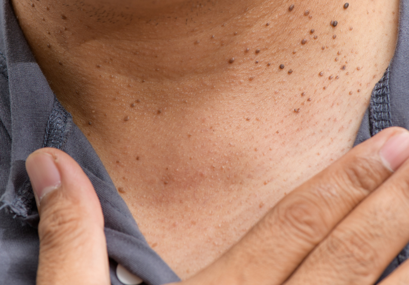 Odoo - Ejemplo 1 para tres columnas