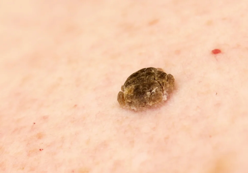 Odoo - Ejemplo 1 para tres columnas