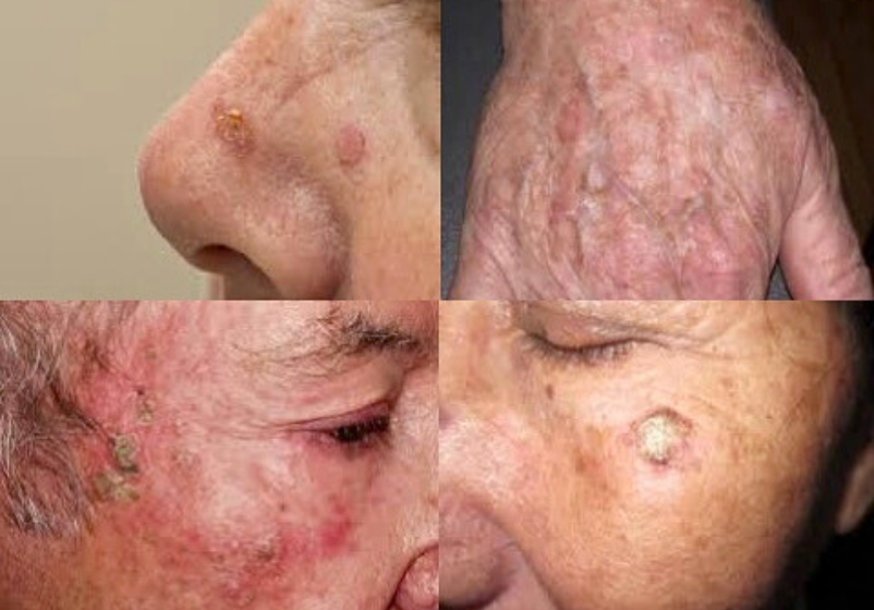 Odoo - Ejemplo 1 para tres columnas