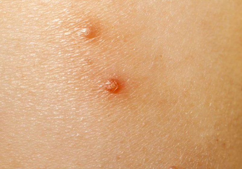 Odoo - Ejemplo 1 para tres columnas