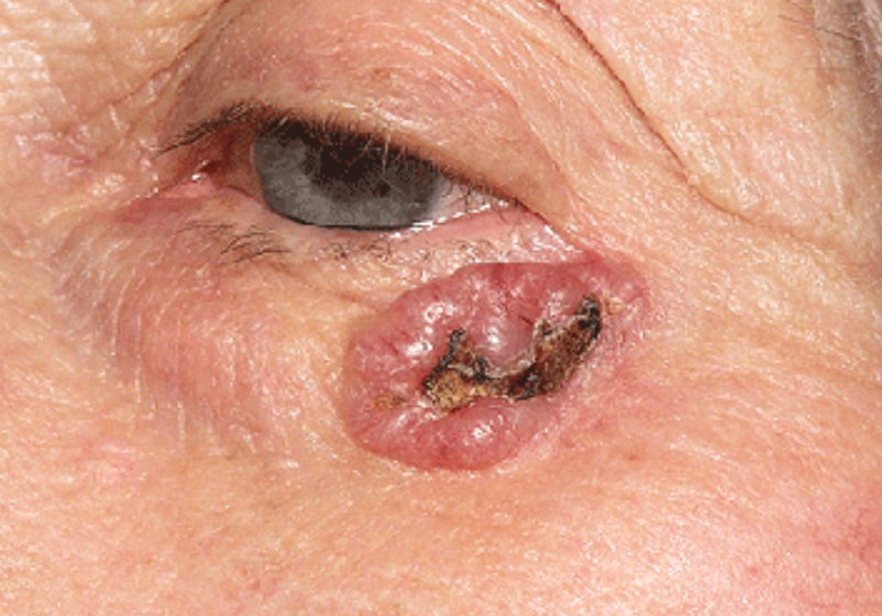 Odoo - Ejemplo 1 para tres columnas