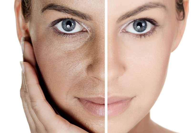 Odoo - Ejemplo 1 para tres columnas